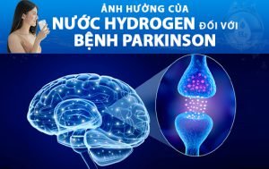 Ảnh Hưởng Nước Hydrogen Đối Với Bệnh Parkinson