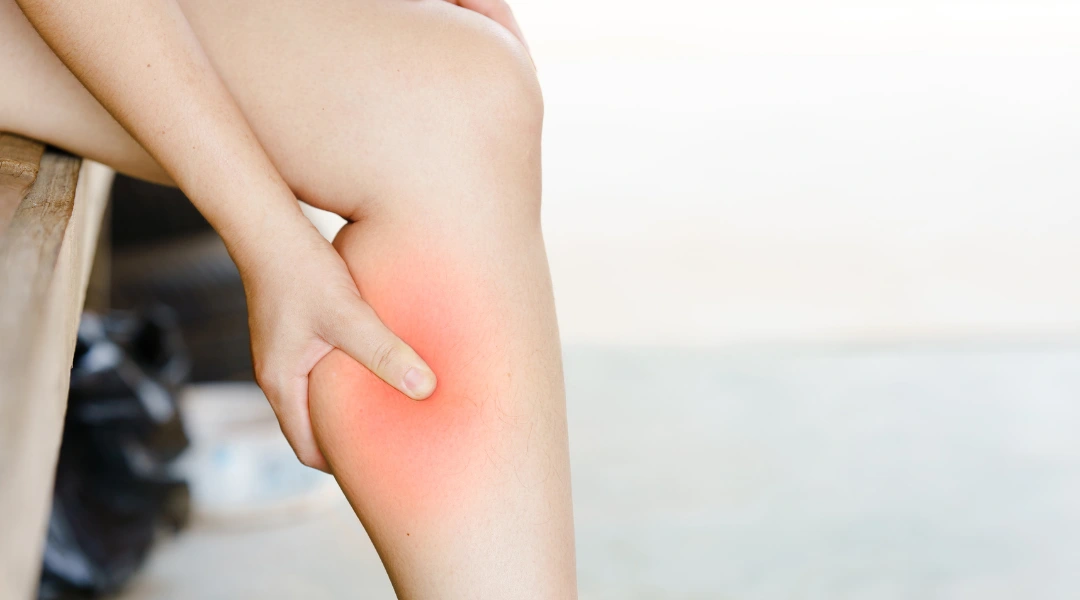 Mỏi cơ sau vận động